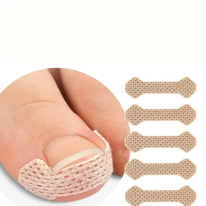 40/100pcs Ingrown Toenail Correction Stickers – Nail Care Patches for Pedicure Treatment & Recovery