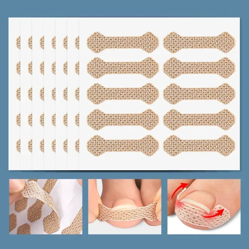 40/100pcs Ingrown Toenail Correction Stickers – Nail Care Patches for Pedicure Treatment & Recovery