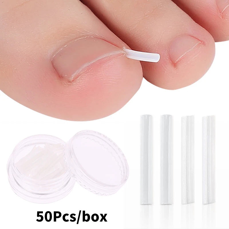 50pcs Ingrown Toenail Correction Tools – Elastic Patch Stickers & Straightening Clip Brace for Pedicure Care