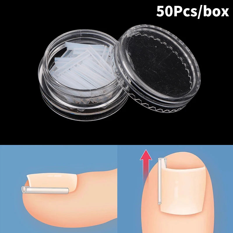 50pcs Ingrown Toenail Correction Tools – Elastic Patch Stickers & Straightening Clip Brace for Pedicure Care