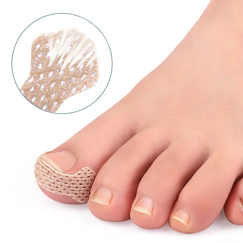 40/100pcs Ingrown Toenail Correction Stickers – Nail Care Patches for Pedicure Treatment & Recovery